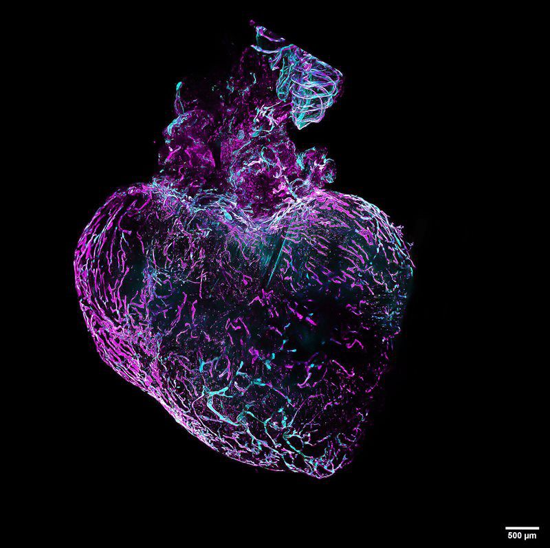 心脏淋巴网络重构