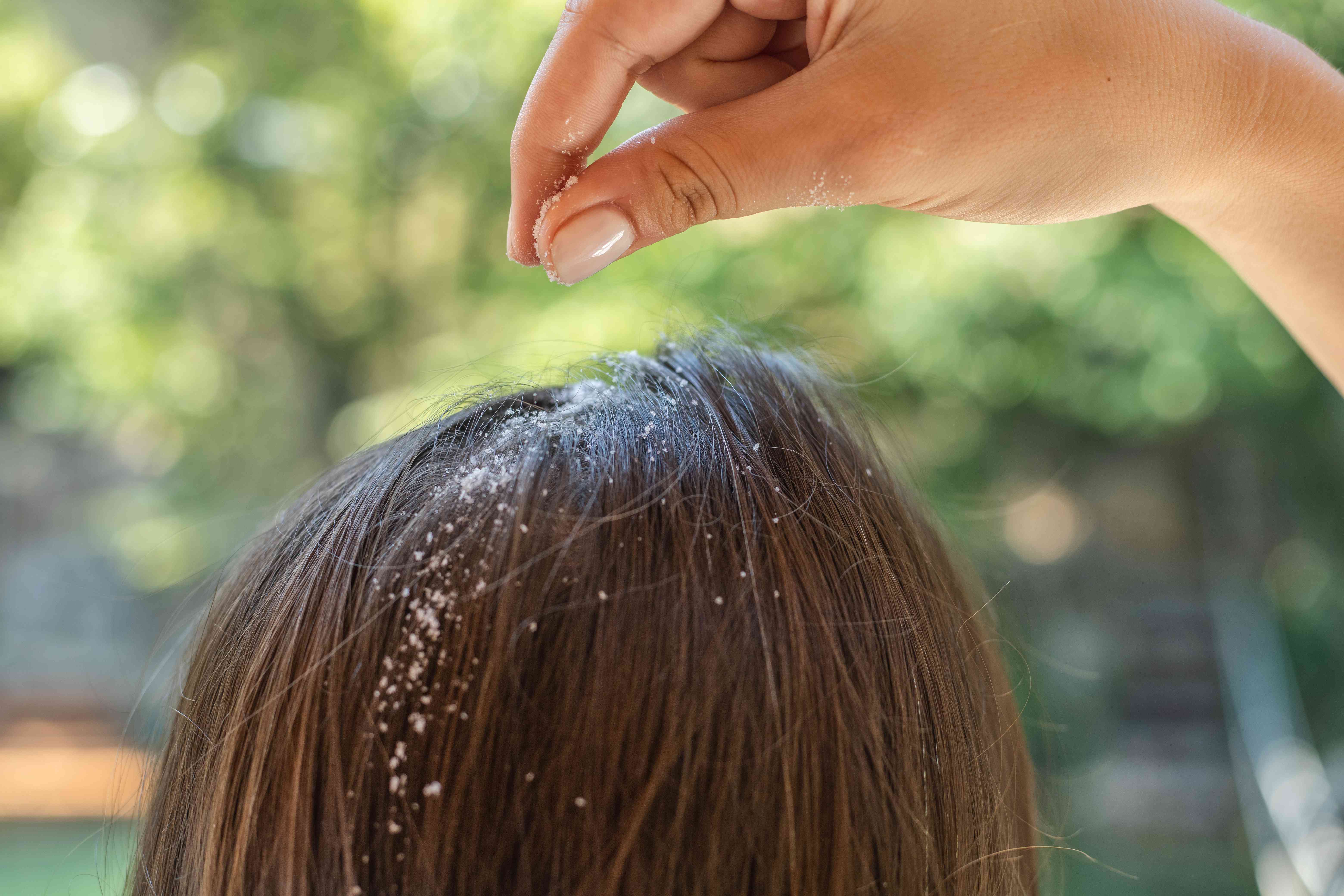 手动将玉米淀粉洒到头发中，从头皮中吸收油脂和油脂