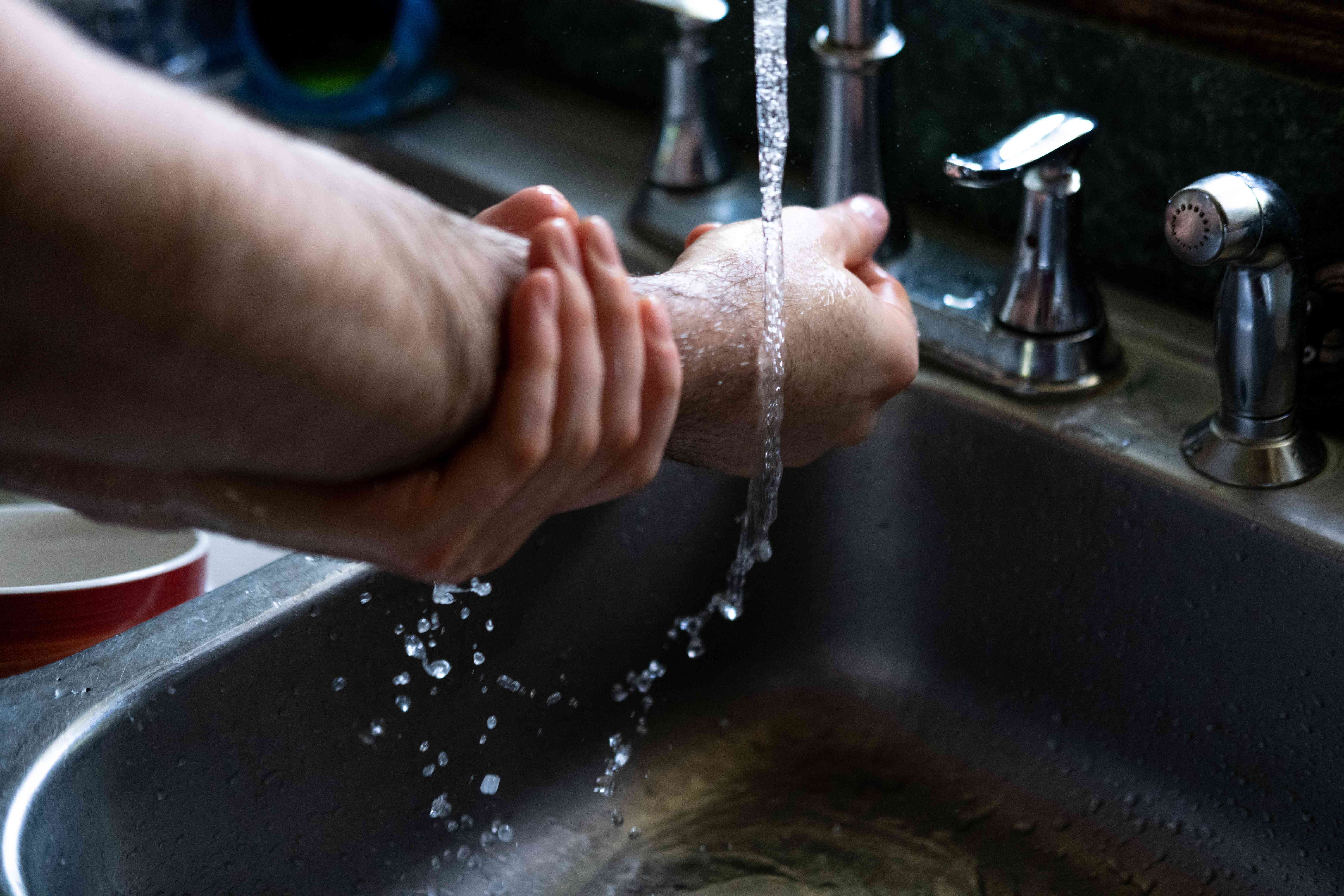 手和手臂有深层清洁厨房水槽的自来水
